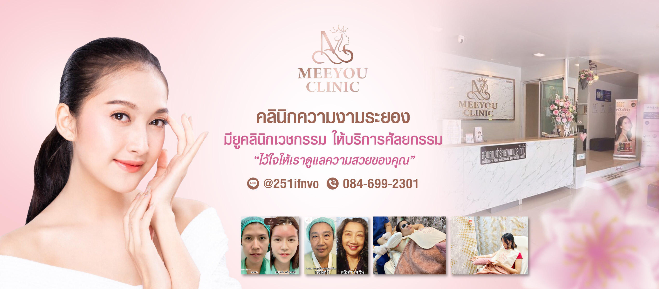 คลินิกความงามระยอง-มียูคลินิก-เวชกรรม